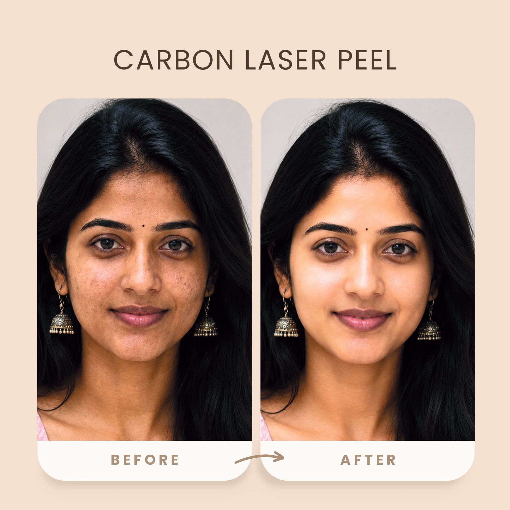 before_after_skin_image1