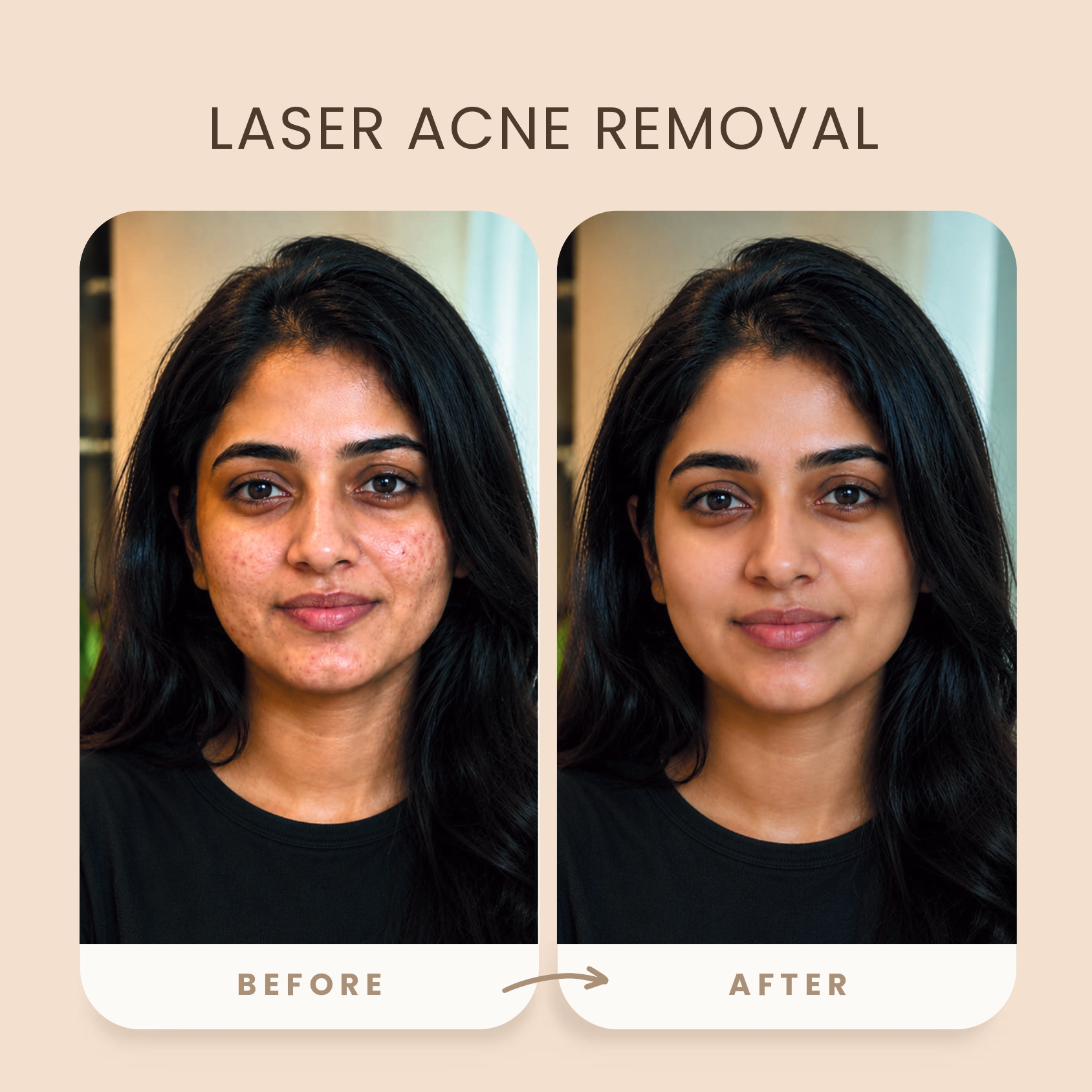 before_after_skin_image2