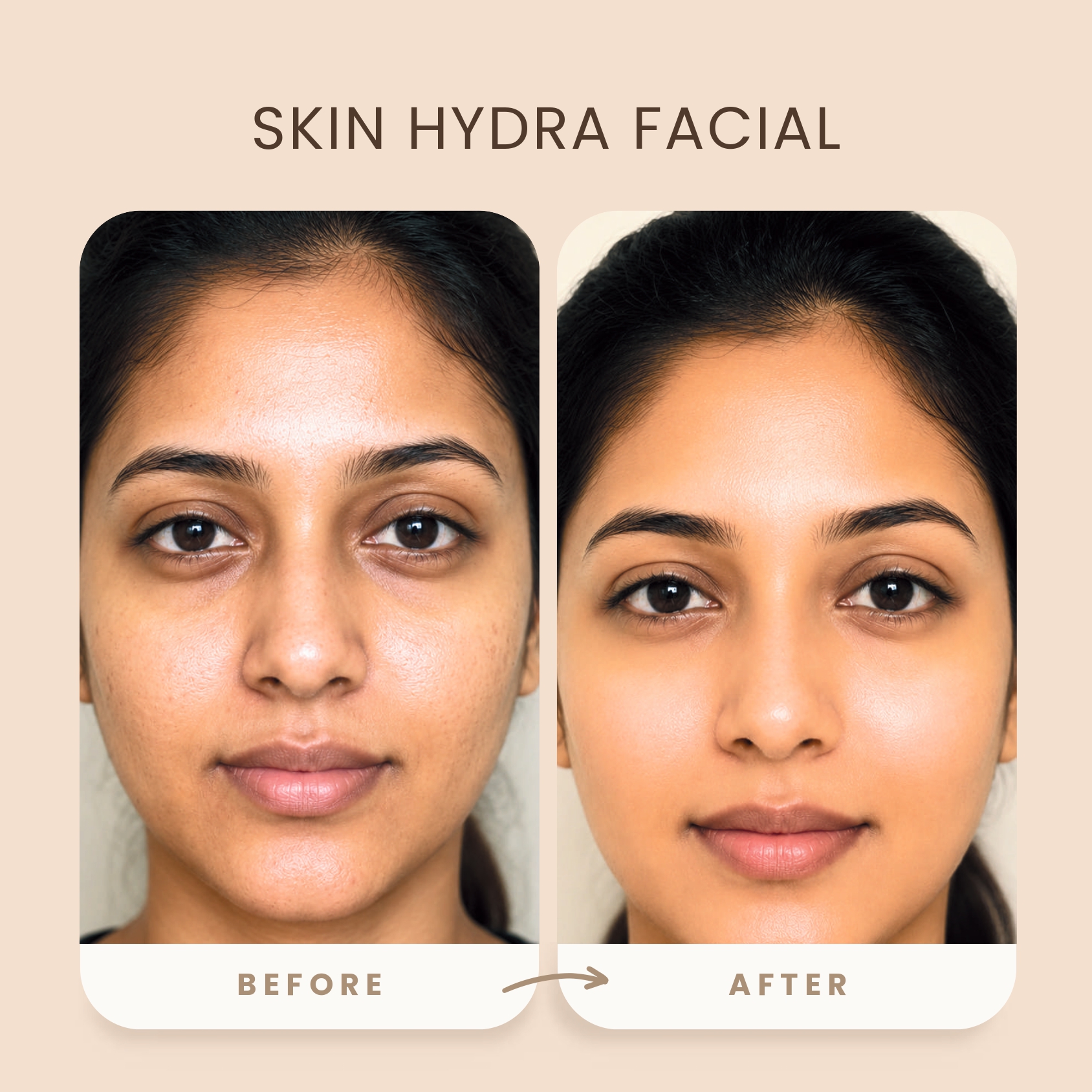 before_after_skin_image3