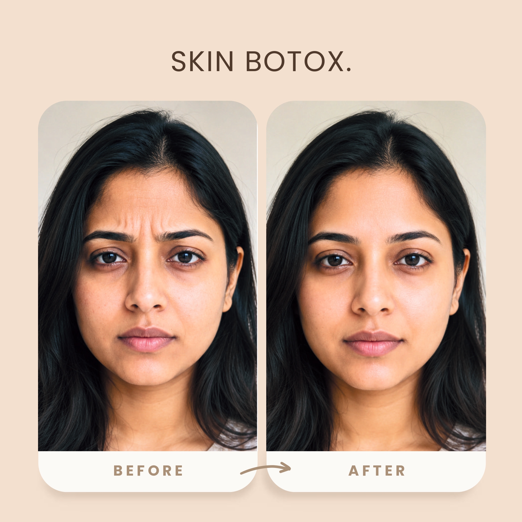 before_after_skin_image4