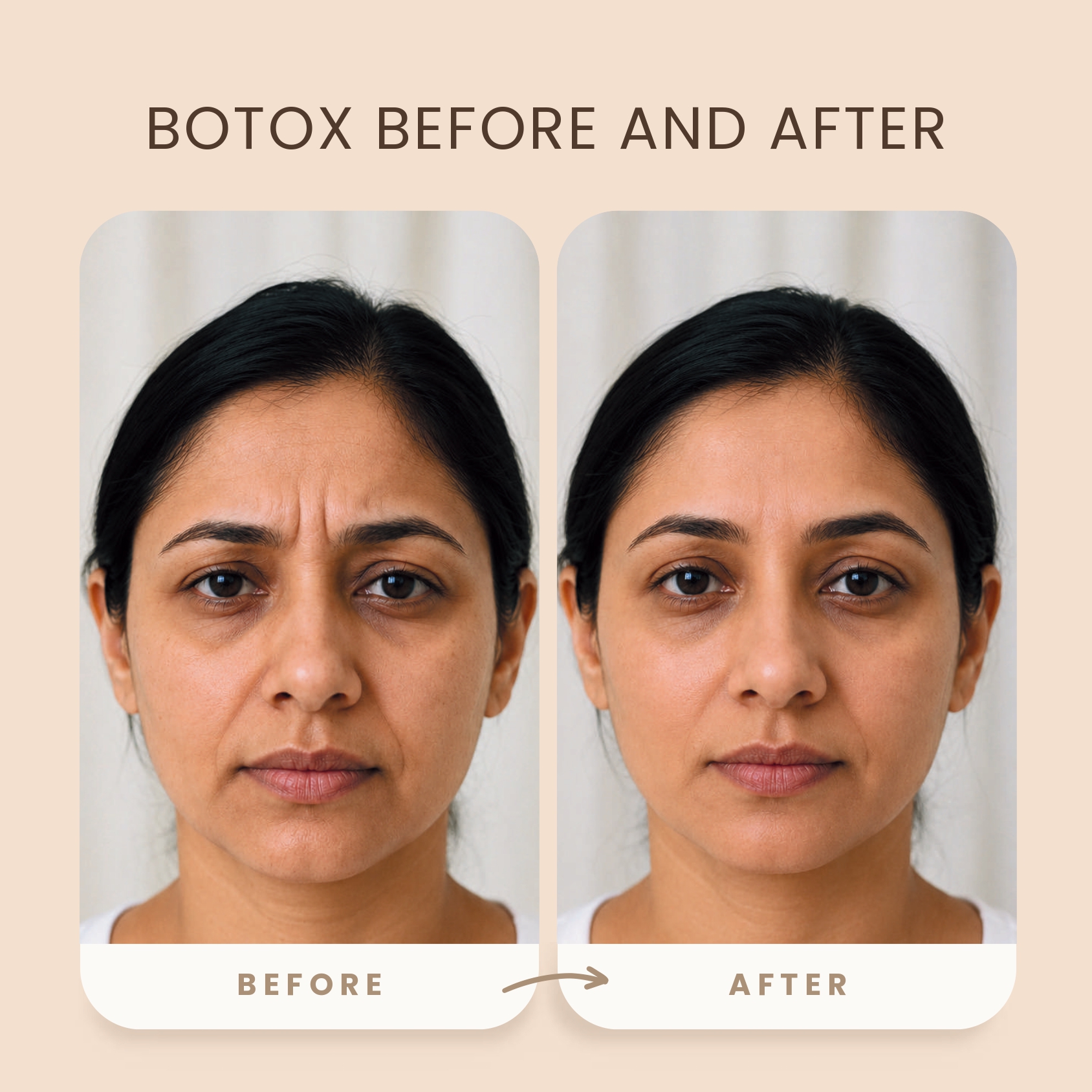 before_after_skin_image5