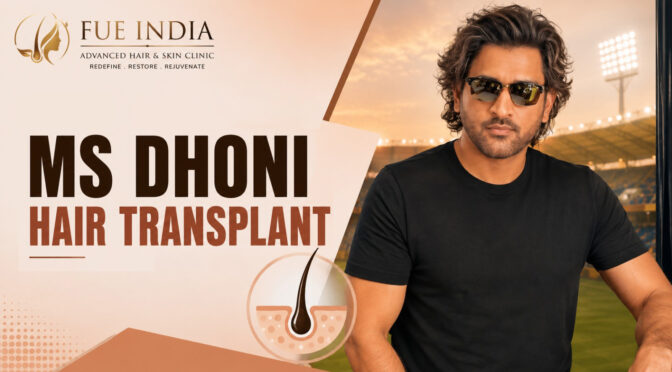 MS Dhoni Hair Transplant
