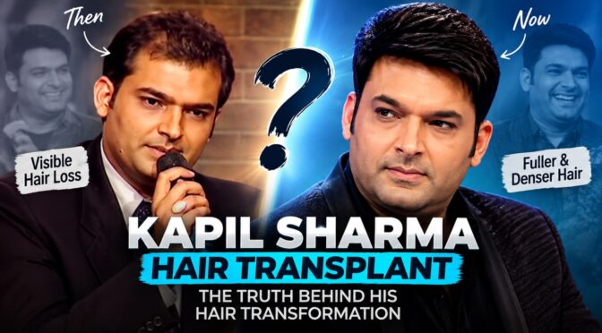 Kapil Sharma Hair Transplant