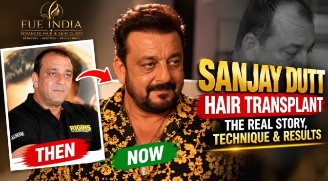 Sanjay Dutt Hair Transplant